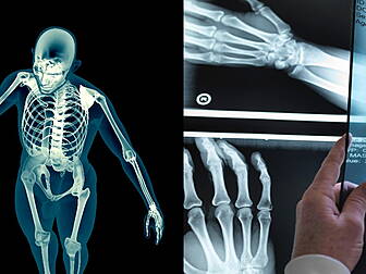 The Icky Truth About Our Bones